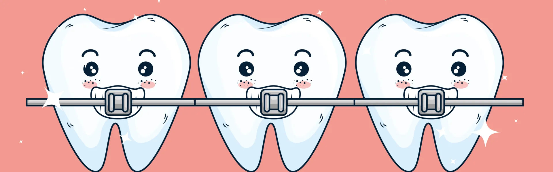 Guide to Teeth Braces